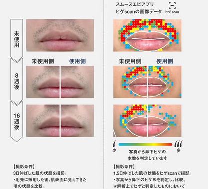 パナソニック 光エステ スムースエピ パワー＆クール ES-WG0B 光美容器 es-wg0b   【90％分返金保証付】新品